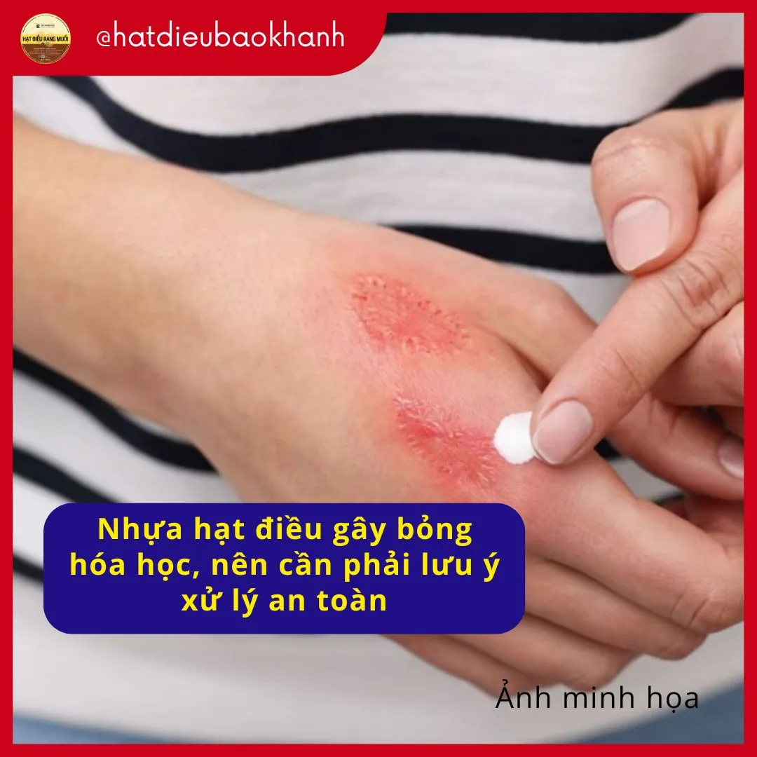bi bong do nhua hat dieu